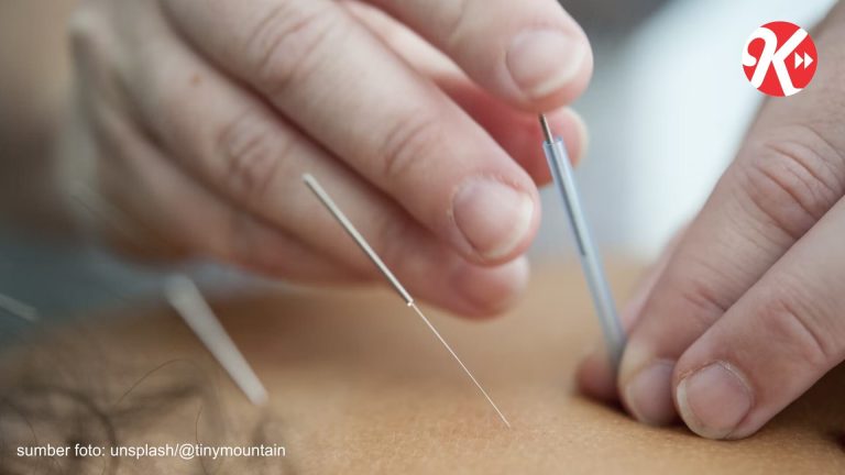 Mengenal Klinik Akupuntur Medik Persembahan Rumah Sakit Kasih Ibu Solo